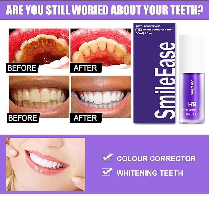 Purple Toothpaste for Teeth Whitening, Purple Whitening Toothpaste for Adults,Tooth Stain Remover Gel - Tooth Whitener Suitable for Smoking, Coffee, and Removing Dental Stone (2fl oz/60ml)