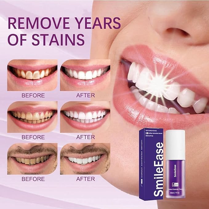 Purple Toothpaste for Teeth Whitening, Purple Whitening Toothpaste for Adults,Tooth Stain Remover Gel - Tooth Whitener Suitable for Smoking, Coffee, and Removing Dental Stone (2fl oz/60ml)