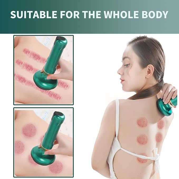 Elouris Cellulite Massage Tool,Lymphatic Drainage Massager,Lymphatic Drainage Tool,Rechargeable Body Sculpting Cupping Machine for Thighs, Arms, Stomach - Cordless Deep Tissue Massager,Gift for Women